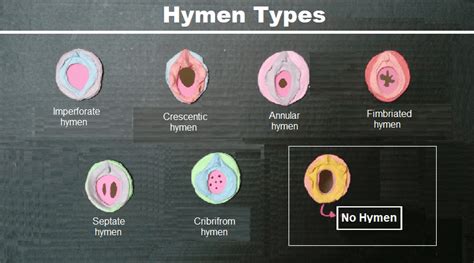 hymen pronunciation